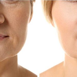 مرکز پوست آرزو علیخانی