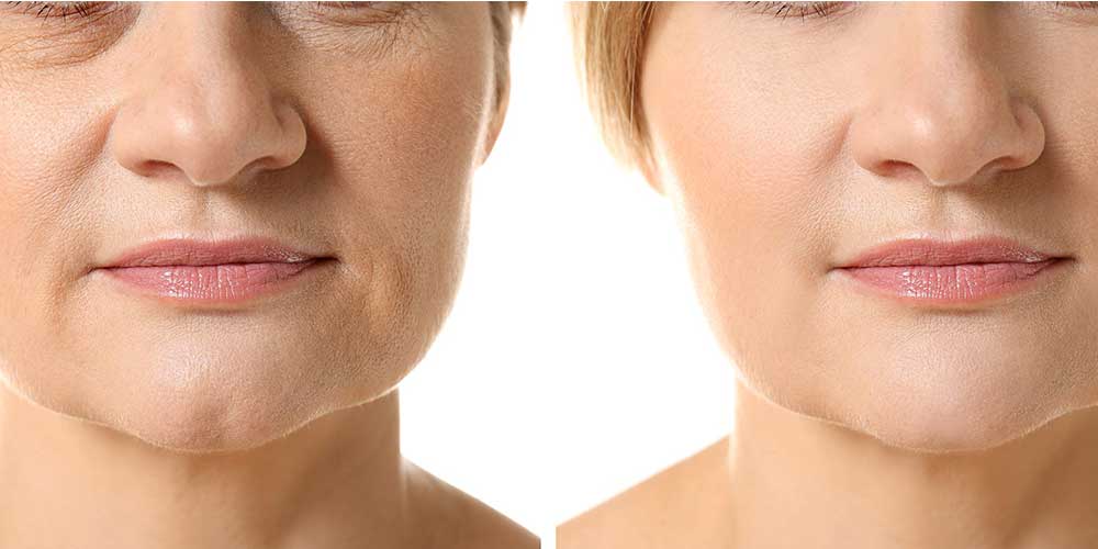 مزونیدلینگ آرزو علیخانی