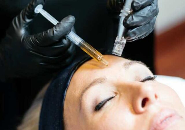 مزونیدلینگ آرزو علیخانی مزونیدلینگ نوشهر