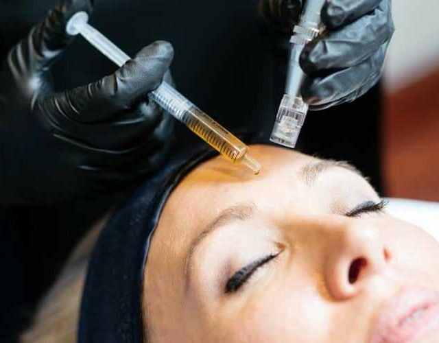 مزونیدلینگ آرزو علیخانی مزونیدلینگ نوشهر