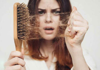 ریزش مو بعد از کراتین (1)