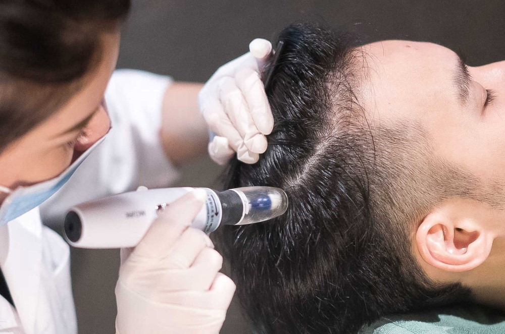 مزوتراپی نوشهر چالوس