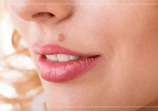 رفع خال در مرکز پوست نوشهر برداشتن خال