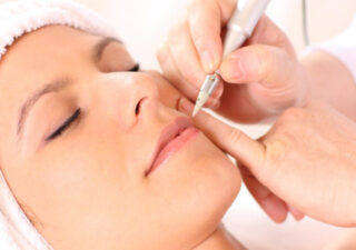 الکترولیز روش قطعی درمان موهای زائد