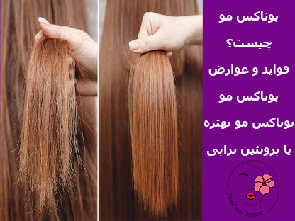 بوتاکس مو نوشهر