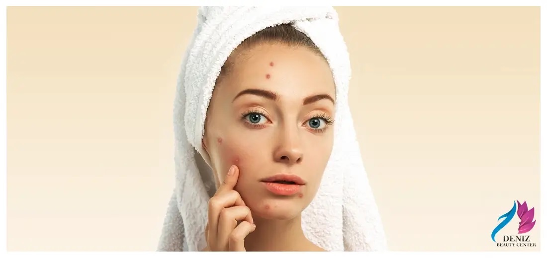 پاکسازی پوست حرفه‌ای در نوشهر (3)